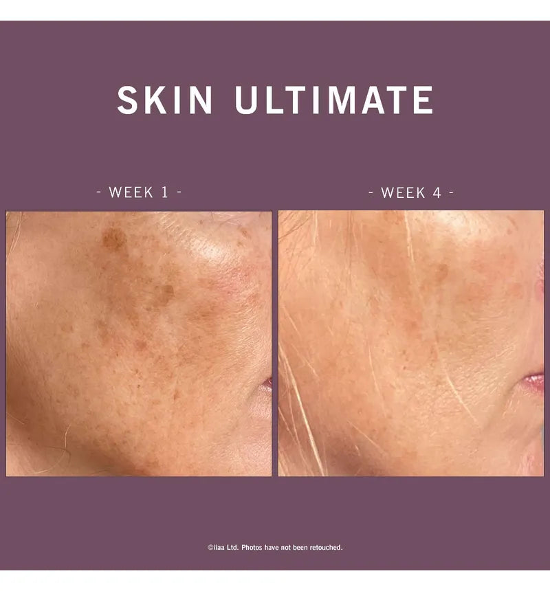 SKIN ULTIMATE 28 Day Pods